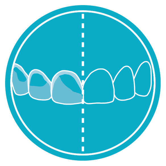 Icon of smile with half the teeth stained and half with stains removed